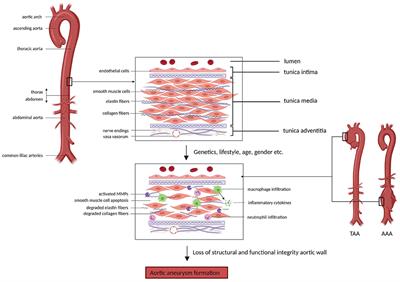 Molecular Imaging of Aortic Aneurysm and Its Translational Power for Clinical Risk Assessment